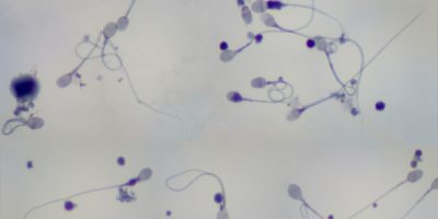 How Quickly Can Sperm Regenerate? Blog Ejaculation Health Men's Health Men's Sexual Health Blog Ejaculation Health Men's Health Men's Sexual Health How Quickly Can Sperm Regenerate?