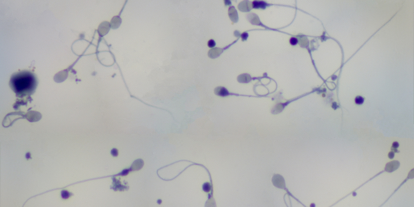 Blog Ejaculation Health Men's Health Men's Sexual Health  How Quickly Can Sperm Regenerate?